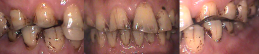 雅世牙醫-美容牙科